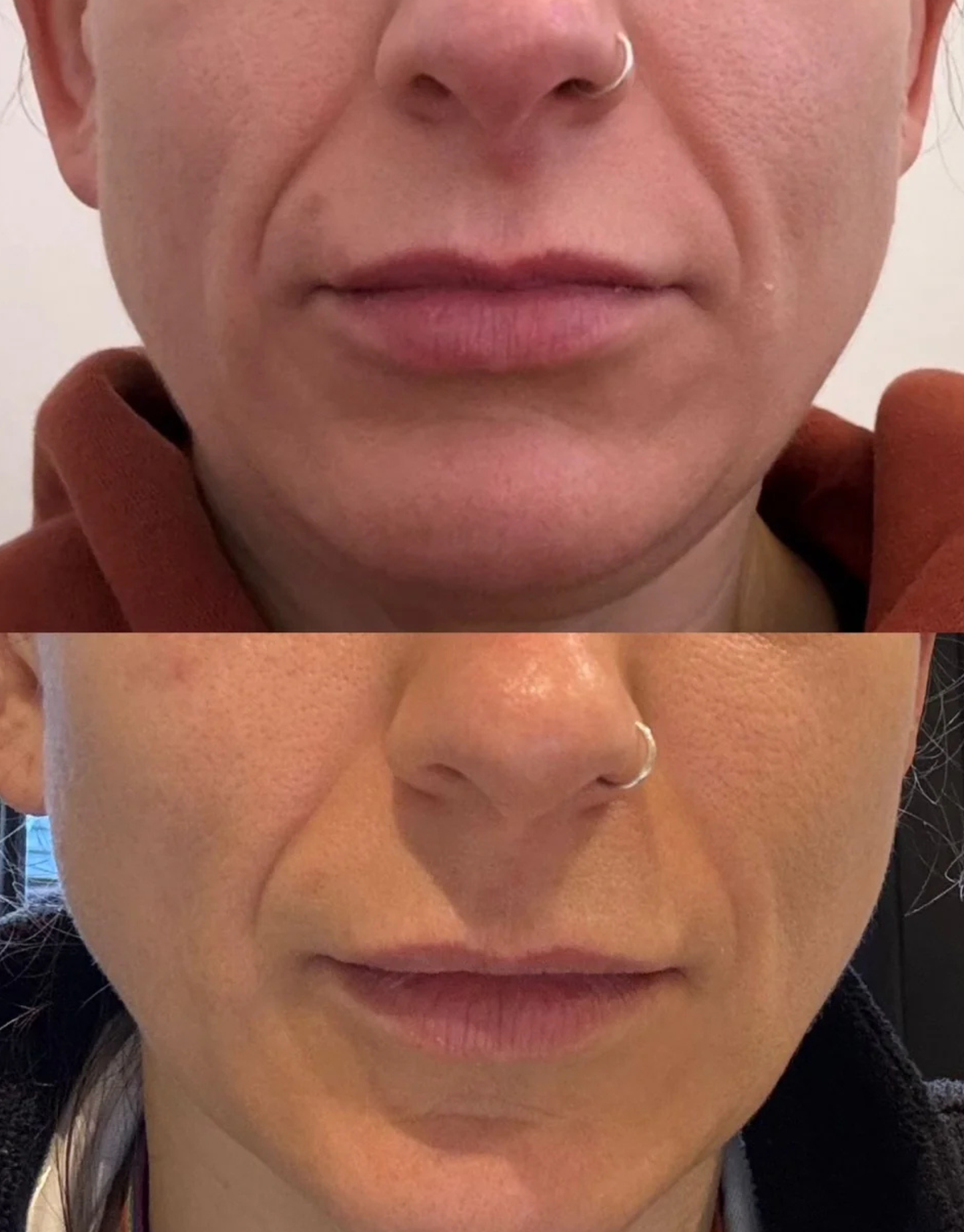 RUCI Collagen Plus Liquid Marine Collagen